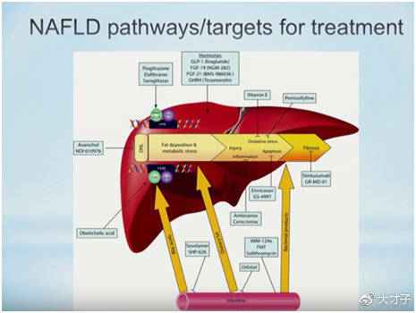 大才子 | 未来医药领域的百亿大市场——NASH
